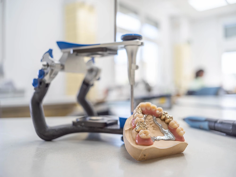 Zahnmodell Zahnmodell mit Zahnersatz auf einem Arbeitstisch im Dentallabor.